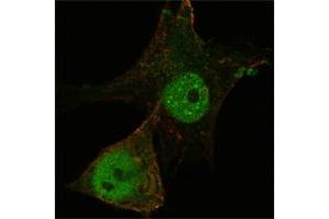 Confocal immunofluorescence analysis of PANC-1 cells using FOXP3 mouse mAb (green).