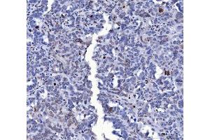 IHC analysis of Lamin A+C/LMNA using anti-Lamin A+C/LMNA antibody (ABIN7601843).