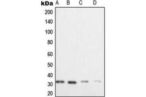 Western blot analysis of XRCC2 expression in HeLa (A), Raji (B), SW480 (C), Caco2 (D) whole cell lysates. (XRCC2 Antikörper  (C-Term))