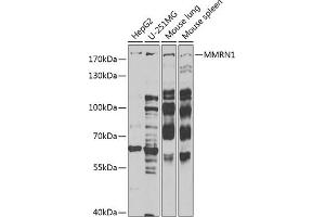 Western blot analysis of extracts of various cell lines, using MMRN1 Antibody (ABIN6129053, ABIN6143926, ABIN6143927 and ABIN6222357) at 1:1000 dilution. (Multimerin 1 Antikörper  (AA 949-1228))