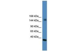 Image no. 1 for anti-Lysine (K)-Specific Demethylase 6A (KDM6A) (N-Term) antibody (ABIN6745346) (KDM6A Antikörper  (N-Term))
