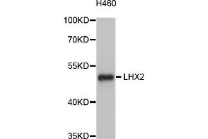 Western blot analysis of extracts of H460 cells, using LHX2 antibody (ABIN5998134) at 1/1000 dilution. (LHX2 Antikörper)