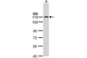 WB Image Sample (30 ug of whole cell lysate) A: Molt-4 , 7. (SMC1A Antikörper  (N-Term))