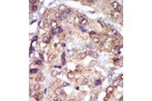 Image no. 2 for anti-V-Yes-1 Yamaguchi Sarcoma Viral Related Oncogene Homolog (LYN) (N-Term) antibody (ABIN359987) (LYN Antikörper  (N-Term))