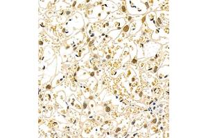 Immunohistochemistry of paraffin embedded mouse placenta using Skar (ABIN7074970) at dilution of 1:900 (400x lens) (p46 Antikörper)