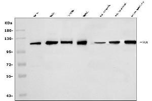 Western blot analysis of SND1 using anti-SND1 antibody (ABIN7600527). (SND1 Antikörper  (AA 20-204))