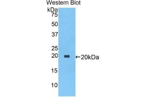 Western blot analysis of the recombinant protein. (SERPINA1 Antikörper  (AA 27-181))