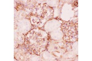 Anti-P Glycoprotein Picoband antibody,  IHC(F): Rat Kidney Tissue (ABCB1 Antikörper  (Middle Region))