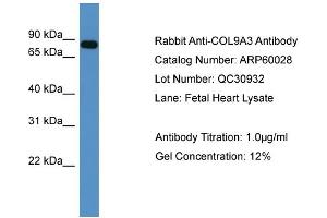 WB Suggested Anti-COL9A3  Antibody Titration: 0. (COL9A3 Antikörper  (C-Term))