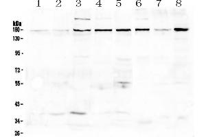 Western blot analysis of EEA1 using anti-EEA1 antibody . (EEA1 Antikörper)