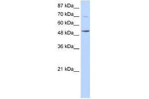 IKZF3 antibody used at 0. (IKZF3 Antikörper  (N-Term))