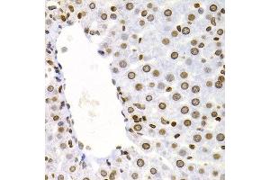 Immunohistochemistry of paraffin-embedded rat liver using NFKB2 antibody at dilution of 1:200 (400x lens). (NFKB2 Antikörper)