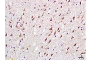 Formalin-fixed and paraffin embedded: rat brain tissue labeled with Anti-MAG-a/L-MAG Polyclonal Antibody , Unconjugated at 1:200, followed by conjugation to the secondary antibody and DAB staining (MAG Antikörper  (AA 551-626))
