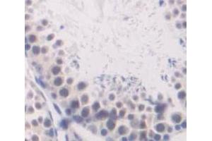 IHC-P analysis of Human Tissue, with DAB staining. (ube3a Antikörper  (AA 158-407))