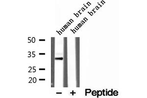 Western blot analysis of extracts of human brain tissue, using CAPZA1 antibody. (CAPZA1 Antikörper  (Internal Region))