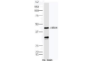Mouse brain lysates probed with Anti-HRH4 Polyclonal Antibody, Unconjugated  at 1:300 in 4˚C.