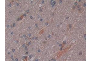 IHC-P analysis of Human Cerebrum Tissue, with DAB staining. (Osteopontin Antikörper  (AA 18-314))