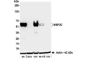 Western Blotting (WB) image for anti-Myocyte Enhancer Factor 2C (MEF2C) (AA 425-475) antibody (ABIN7795747) (Rekombinanter MEF2C Antikörper  (AA 425-475))
