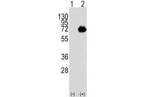 Western blot analysis of ACOX1 antibody and 293 cell lysate either nontransfected (Lane 1) or transiently transfected with the ACOX1 gene (2). (ACOX1 Antikörper  (AA 629-659))