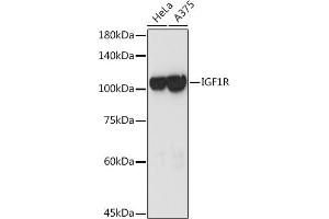 Western blot analysis of extracts of various cell lines, using IGF1R antibody (ABIN3020767, ABIN3020768, ABIN3020769 and ABIN6213714) at 1:3000 dilution. (IGF1R Antikörper  (AA 660-760))
