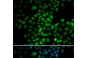 Immunofluorescence analysis of HeLa cells using C11orf30 Polyclonal Antibody