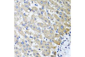 Immunohistochemistry of paraffin-embedded human liver injury using RBP2 antibody at dilution of 1:100 (x40 lens).