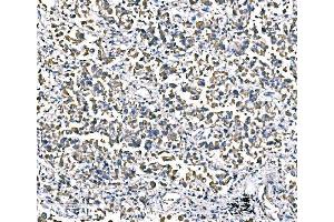 IHC analysis of ATG16L1 using anti-ATG16L1 antibody (ABIN7602244). (ATG16L1 Antikörper  (AA 66-359))