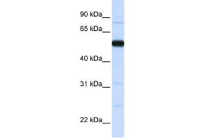WB Suggested Anti-THUMPD2 Antibody Titration:  0. (THUMPD2 Antikörper  (N-Term))