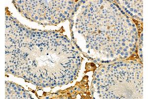 ABIN6257643 and ABIN6274758 at 1/100 staining Mouse testis tissue by IHC-P. (RPS5 Antikörper  (Internal Region))