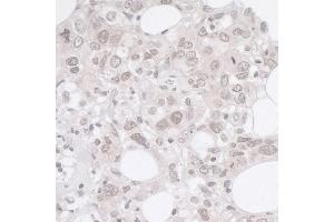 anti-Adhesion Regulating Molecule 1 (Adrm1) (AA 357-407) antibody