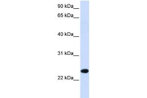 WB Suggested Anti-PILRB Antibody Titration:  0.