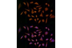 Immunofluorescence (IF) image for anti-Midkine (Neurite Growth-Promoting Factor 2) (MDK) (AA 21-143) antibody (ABIN3020791)