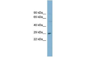 WB Suggested Anti-DNASE1 Antibody Titration:  0.