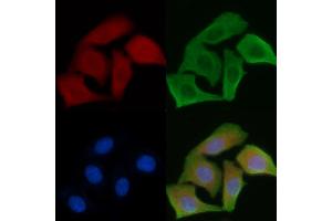 ABIN6264151 and ABIN6279649 staining Hela cells by IF/ICC. (PEX5 Antikörper  (Internal Region))