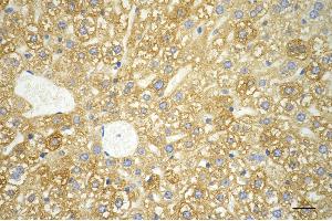 Immunohistochemistry was performed on paraffin-embedded mouse liver using ACAT1 antibody (ABIN7797438), 1:200). (ACAT1 Antikörper)