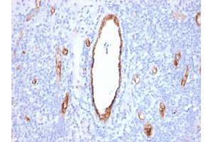 Formalin-fixed, paraffin-embedded human Tonsil stained with vWF Mouse Monoclonal Antibody (VWF/2480).