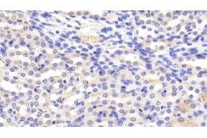 Detection of CAT in Mouse Kidney Tissue using Polyclonal Antibody to Catalase (CAT) (Catalase Antikörper  (AA 80-239))