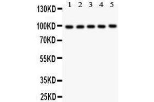 Anti- HCN1 antibody, Western blotting All lanes: Anti HCN1  at 0. (HCN1 Antikörper  (AA 618-890))