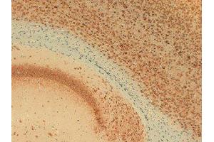 Immunohistochemistry (IHC) image for anti-Potassium Voltage-Gated Channel, Shab-Related Subfamily, Member 1 (KCNB1) (C-Term) antibody (ABIN6658107)