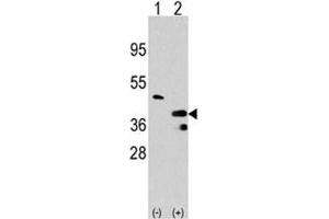 Western blot analysis of PRMT1 antibody and 293 cell lysate either nontransfected (Lane 1) or transiently transfected with the PRMT1 gene (2). (PRMT1 Antikörper  (AA 316-347))