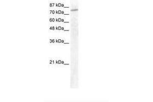 Image no. 1 for anti-General Transcription Factor IIIC, Polypeptide 3, 102kDa (GTF3C3) (AA 40-89) antibody (ABIN202944) (GTF3C3 Antikörper  (AA 40-89))