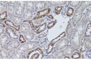 Immunohistochemistry of paraffin-embedded Mouse kidney using ITGAV Polyclonal Antibody at dilution of 1:50 (40x lens). (CD51 Antikörper)