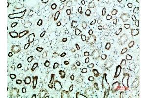 Immunohistochemical analysis of paraffin-embedded human-kidney, antibody was diluted at 1:200 (PTH1R Antikörper  (AA 1268-1341))