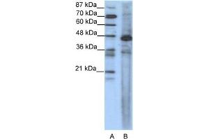 WB Suggested Anti-SRF Antibody Titration:  1. (SRF Antikörper  (N-Term))