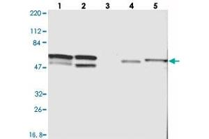 Western blot analysis of Lane 1: RT-4, Lane 2: U-251 MG, Lane 3: Human Plasma, Lane 4: Liver, Lane 5: Tonsil with CDCA7 polyclonal antibody  at 1:250-1:500 dilution. (CDCA7 Antikörper)