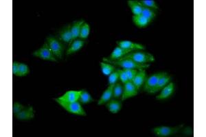 Immunofluorescence staining of HepG2 cells with ABIN7142464 at 1:100, counter-stained with DAPI. (HOGA1 Antikörper  (AA 1-164))