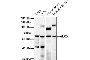 Western blot analysis of extracts of various cell lines, using GLP2R antibody (ABIN6127974, ABIN6141141, ABIN6141142 and ABIN6222287) at 1:500 dilution. (GLP2R Antikörper  (AA 1-180))