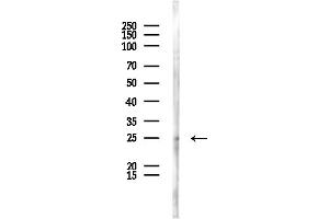 anti-MAD2 Mitotic Arrest Deficient-Like 2 (MAD2L2) (Internal Region) antibody