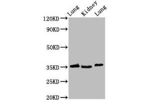 Western Blot Positive WB detected in: Rat lung tissue, Rat kidney tissue, Mouse lung tissue All lanes: HOXD1 antibody at 2. (HOXD1 Antikörper  (AA 59-131))