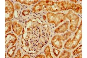 Immunohistochemistry of paraffin-embedded human kidney tissue using ABIN7160805 at dilution of 1:100 (SLC9A3R2 Antikörper  (AA 106-313))